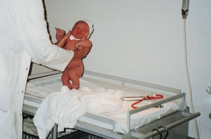 aktiv-primitive-refleks